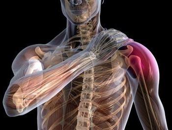 Bolitis ramenog zgloba: uzroci i liječenje