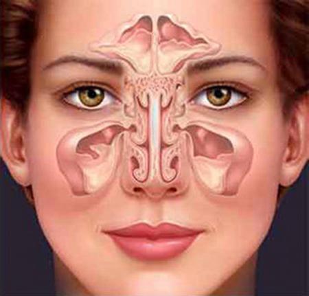Je li moguće grijati nos s genyantritisom