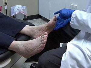Uzgoj noktiju na nogama: uzroci i metode liječenja